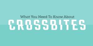 What You Need to Know About Crossbites 